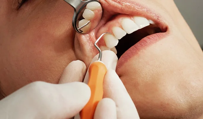 Best dentist antalya turkey for zirconium crowns