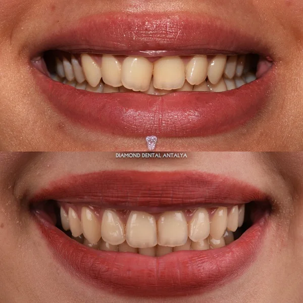orto-patient-3