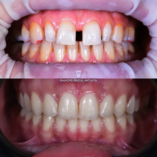orto-patient-5