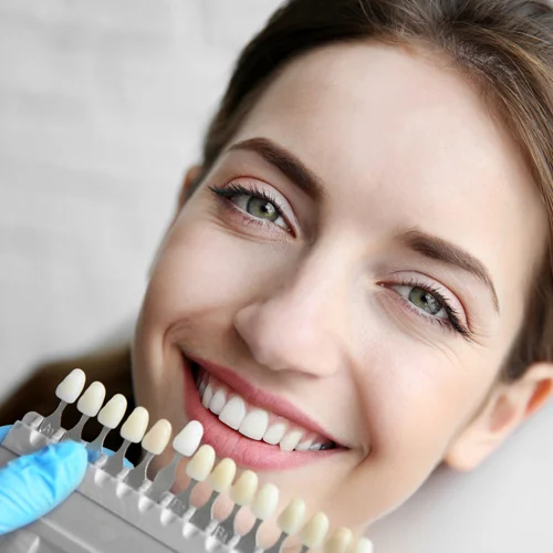 hollywood smile turkey antalya, smile makeover antalya, smile makeover turkey