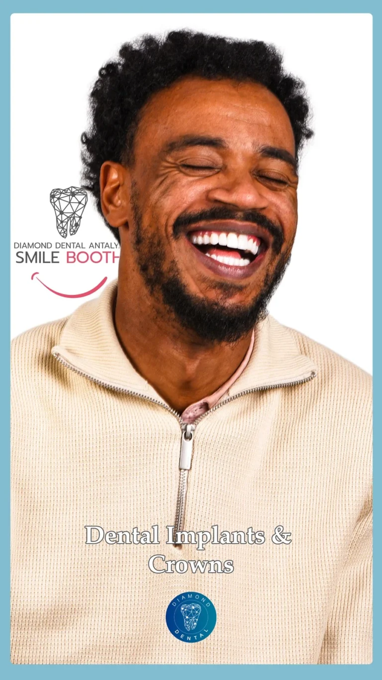 Diamond Dental Antalya, dental implants antalya turkey, dental implant prices antalya turkey, dental implant packages turkey, dental implant brands, quality dental implant prices, zygomatic dental implants antalya turkey