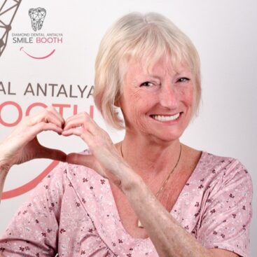 zygomatic dental implants antalya turkey, zygomatic implants turkey, zygomatic implants antalya, zigoma implant