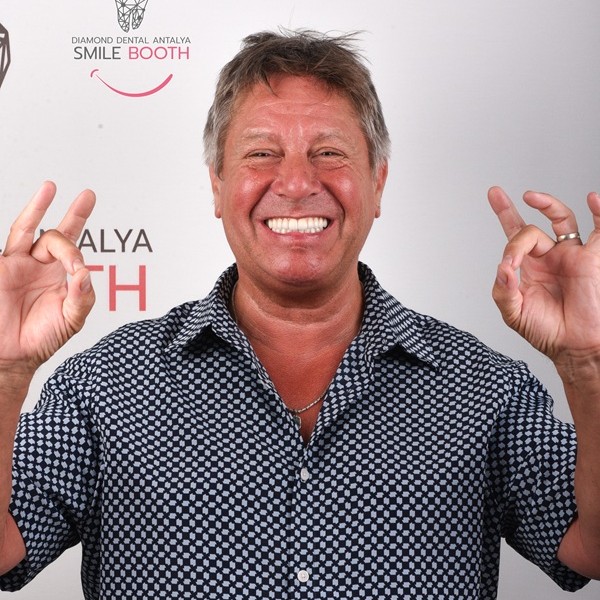 All-on-4 Dental Implants in Antalya Turkey