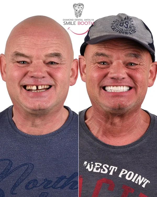Peter-4