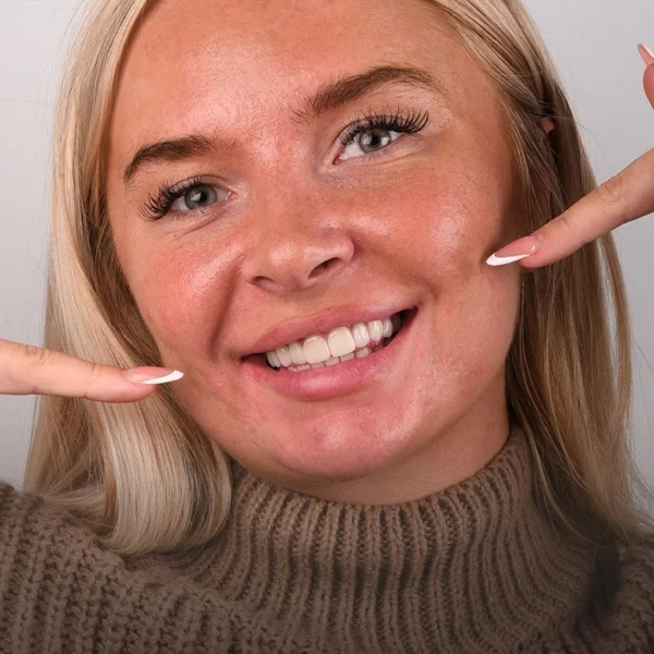 Emax veneers treatment before after results in Turkey Antalya, emax veneers turkey antalya