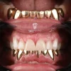 gold tooth, gold teeth, gold tooth cap, gold tooth crown, gold dental crown, gold tooth filling, gold teeth cost, gold teeth Turkey, gold crown tooth, gold tooth dentist, golden crowns in antalya, golden crowns in turkey